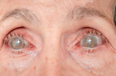 diabetes affect the eyes