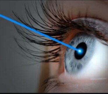 تصحيح النظر وإجراء عملية الليزك للعيون في المركز الإسباني الملكي